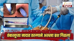 तंबाखूच्या नादात तरुणाने अख्खा ब्रश गिळला, तब्बल 12 तास टूथब्रश पोटातच राहिला, अखेर...