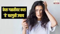 तरुणपणीच होतोय केस गळतीचा त्रास? मग करा 'हे' घरगुती उपाय, घनदाट होतील डोक्यावरचे केस 