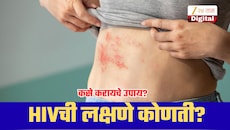 ताप, थकवा आणि पुरळ...; ही HIVची लक्षणे आहेत का? जाणून घ्या वस्तुस्थिती, प्रतिबंधात्मक उपाय!