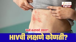 ताप, थकवा आणि पुरळ...; ही HIVची लक्षणे आहेत का? जाणून घ्या वस्तुस्थिती, प्रतिबंधात्मक उपाय!