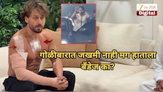 टायगर श्रॉफला गोळी लागली नाही तरी हातावर आणि छातीला बँडेज का? गंभीर जखमा कशा झाल्या?