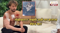 टायगर श्रॉफला गोळी लागली नाही तरी हातावर आणि छातीला बँडेज का? गंभीर जखमा कशा झाल्या?