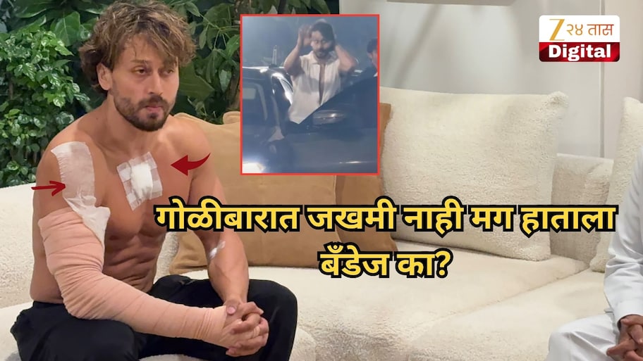 टायगर श्रॉफला गोळी लागली नाही तरी हातावर आणि छातीला बँडेज का? गंभीर जखमा कशा झाल्या?